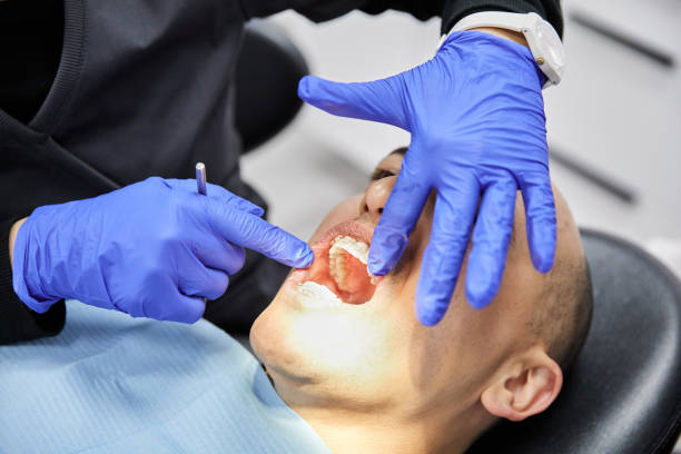 Best Emergency Gum Treatment in Three Forks, MT